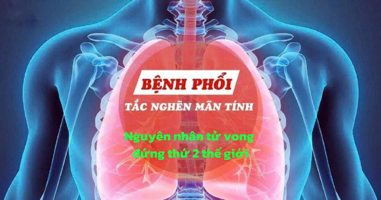  CHỦ ĐỘNG DỰ PHÒNG, SÀNG LỌC SỚM VÀ QUẢN LÝ TOÀN DIỆN BỆNH PHỔI MẠN TÍNH